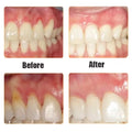 Damaged Gum Repair Care Gel Serum Relieve Sore Gums Allergy Deep Cleaning Teeth Stains Tartar Serum Dental Caries Toothpaste