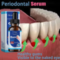 Damaged Gum Repair Care Gel Serum Relieve Sore Gums Allergy Deep Cleaning Teeth Stains Tartar Serum Dental Caries Toothpaste